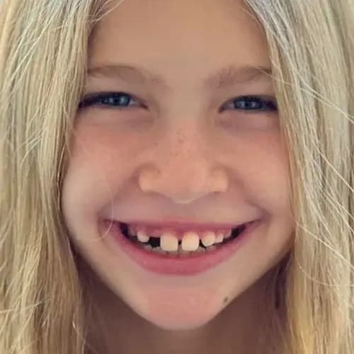 Sonrisa de una niña rubia antes del tratamiento Invisalign®