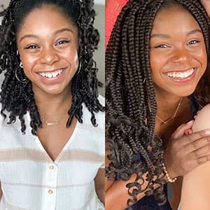 Antes y después de la sonrisa de una chica de color con el tratamiento Invisalign®