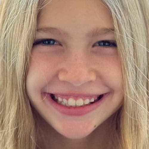 Sonrisa de una niña rubia después del tratamiento Invisalign®